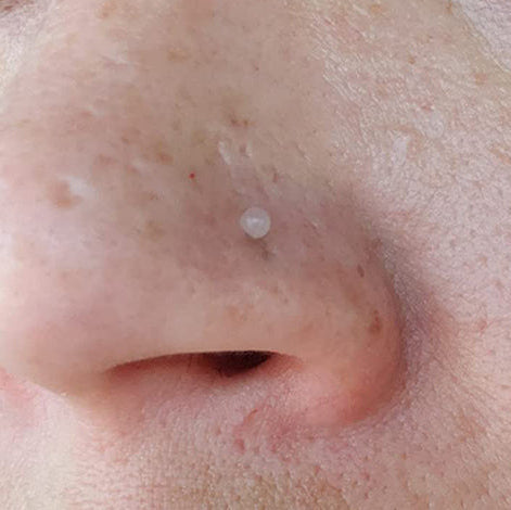 Clear Flexible Nose Screw Retainer